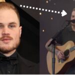 Did Zach Bryan Get a Hair Transplant? Fans Think So